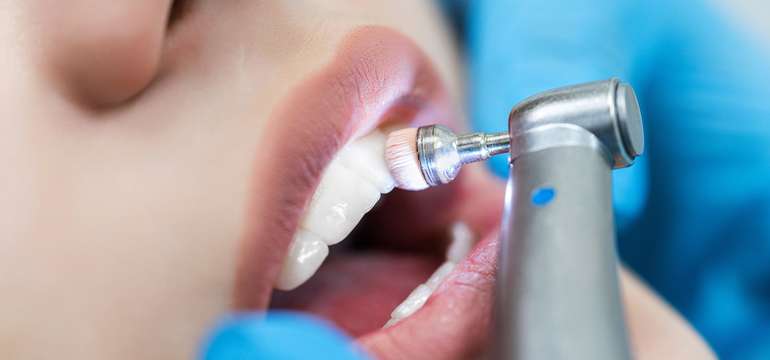 Dentálna hygiena, belenie zubov, ozónoterapia v 24 DENTAL