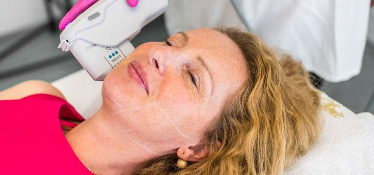 Neinvazívny facelifting Hifu SMAS ultherapia