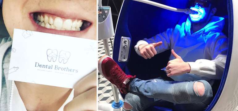 Bielenie zubov do Dental Brothers