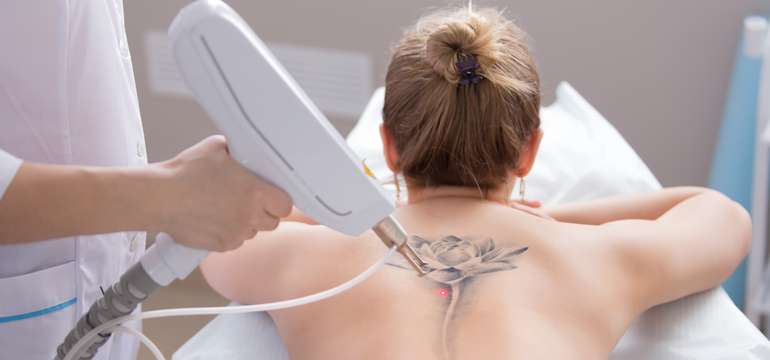 Laserové odstránenie tetovanie alebo PMU v Maya Beauty Clinic