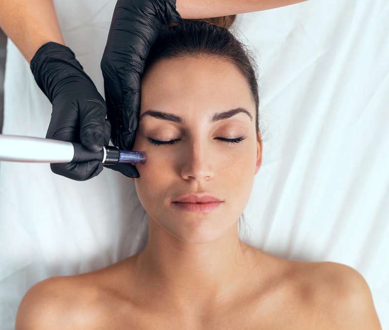 Prístrojová mezoterapia v salóne L&W beauty v Bratislave