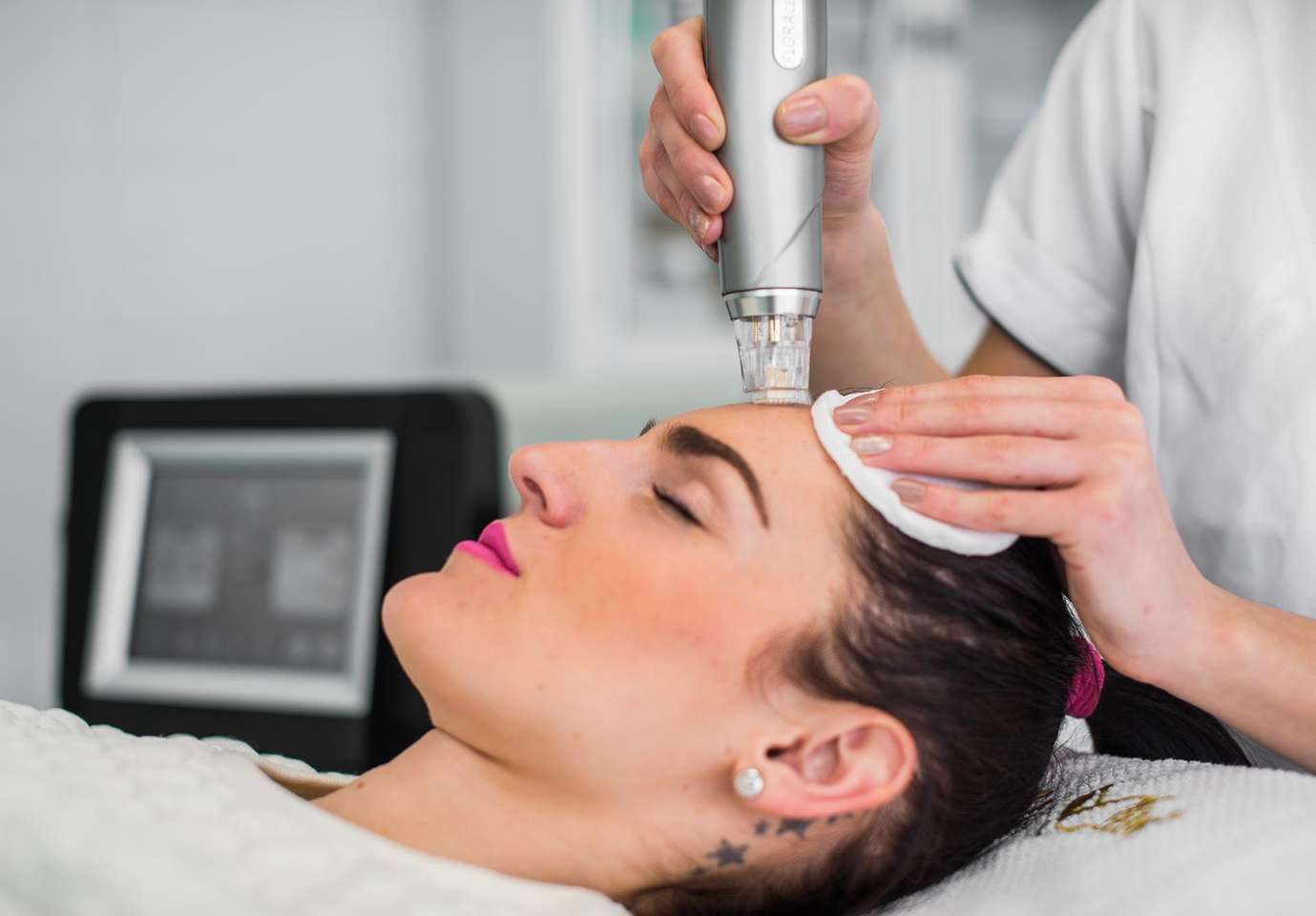 Medicínska frakčná mikroihličková rádiofrekvencia pre omladenie, pozdvihnutie kontúr, liečbu akné, jazvičiek a strií