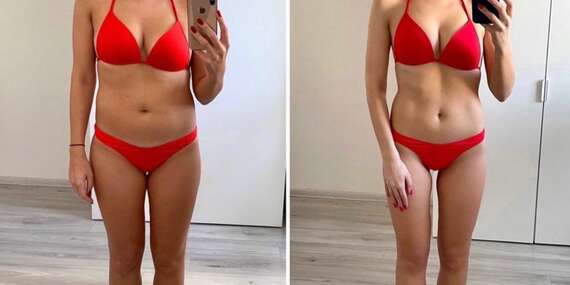 Najúčinnejšie kardio v súčasnosti a moderné tvarovanie postavy: InfraShape a Duo Shaper/Bratislava - Petržalka