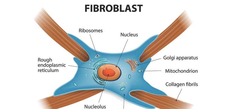 Fibroblast - nechirurgický lifting očného okolia alebo odstránenie vrások