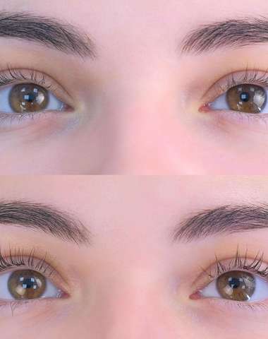 Lash lift alebo predĺženie mihalníc