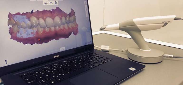 Novinka: 3D virtuálny model vašich zubov