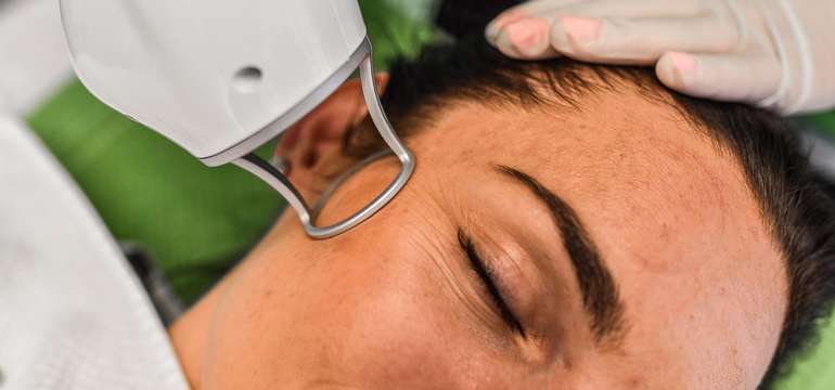 Frakčný resurfacing CO2 - účinné omladenie vašej pokožky v medicínskom centre Crystal Esthetic Clini