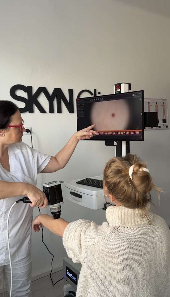 Vyšetrenia znamienok celotelovým skenom pomocou najmodernejšieho prístroja FotoFinder v SKYN Clinic