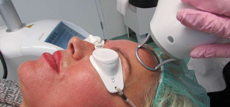 Frakčný resurfacing CO2 - účinné omladenie vašej pokožky v medicínskom centre Crystal Esthetic Clini