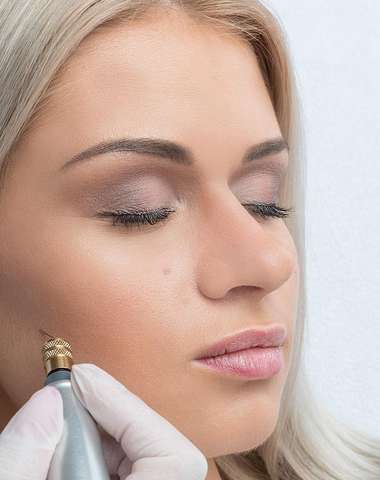 Fibroblast - nechirurgický lifting očného okolia alebo odstránenie vrások