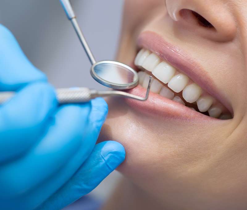 Komplexná dentálna hygiena s fluoridáciou