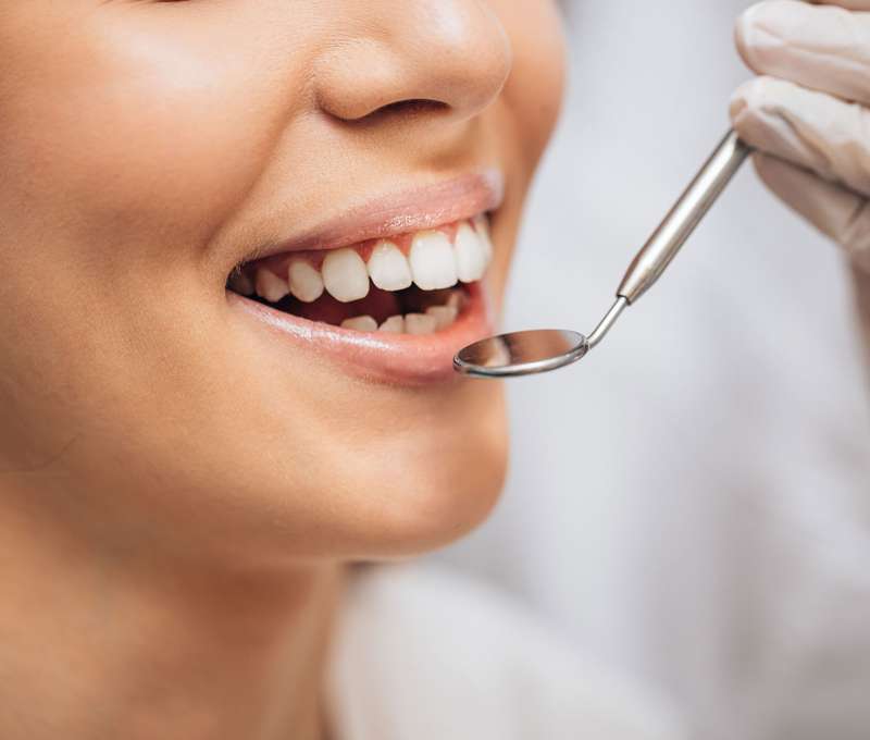 Dentálna hygiena alebo bielenie zubov