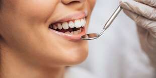 Dentálna hygiena alebo bielenie zubov