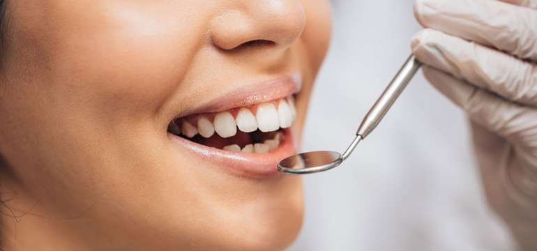 Dentálna hygiena, bielenie zubov alebo nová zirkónová korunka