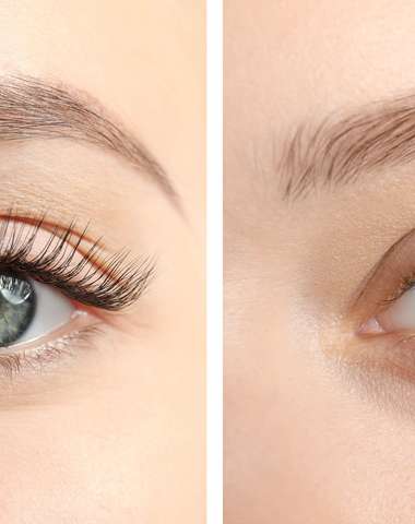 Lash lift alebo predĺženie mihalníc