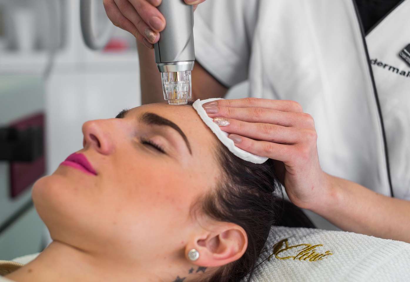 Medicínska frakčná mikroihličková rádiofrekvencia pre omladenie, pozdvihnutie kontúr, liečbu akné, jazvičiek a strií