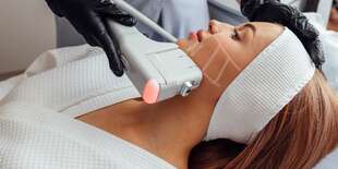 Neinvazívny facelifting HIFU - omladnite až o 5 rokov