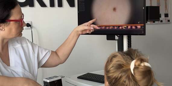 Vyšetrenia znamienok celotelovým skenom pomocou najmodernejšieho prístroja FotoFinder v SKYN Clinic/Bratislava - Nové Mesto