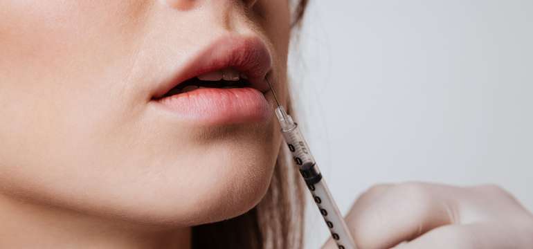 Aplikácia 1 ml kyseliny hyalurónovej Restylane Original