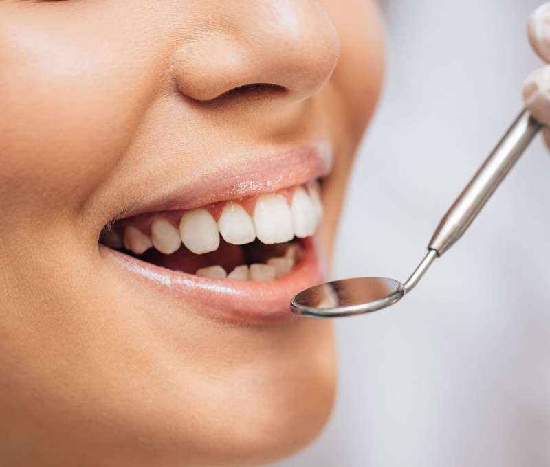 Dentálna hygiena alebo bielenie zubov