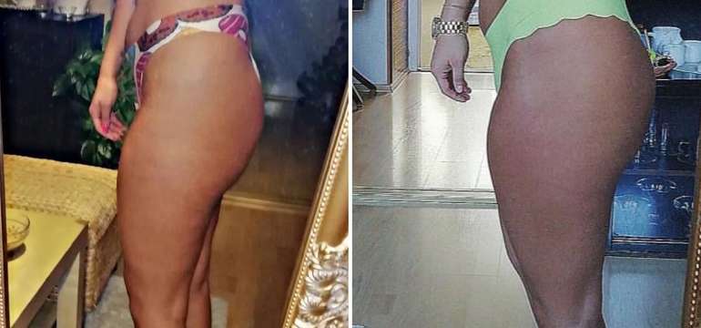Výsledky, ktoré môžete docieliť s Butterfly Body Wrap Set