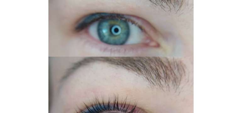 Lash lifting a Lash botox pre dlhšie a hustejšie mihalnice 