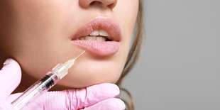 Russian lips alebo odstránenie vrások kyselinou hyalurónovou