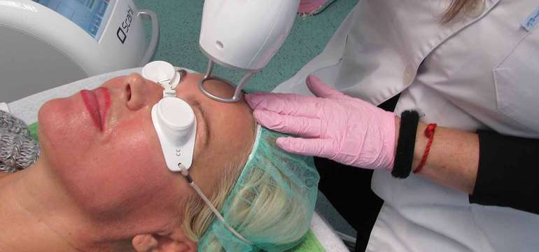 Frakčný resurfacing CO2 - účinné omladenie vašej pokožky v medicínskom centre Crystal Esthetic Clini