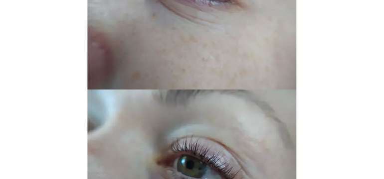 Lash lifting a Lash botox pre dlhšie a hustejšie mihalnice 