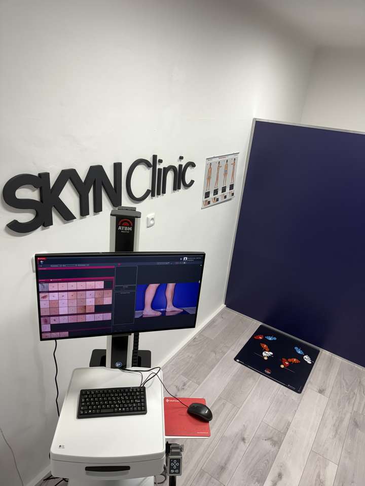 Vyšetrenia znamienok celotelovým skenom pomocou najmodernejšieho prístroja FotoFinder v SKYN Clinic