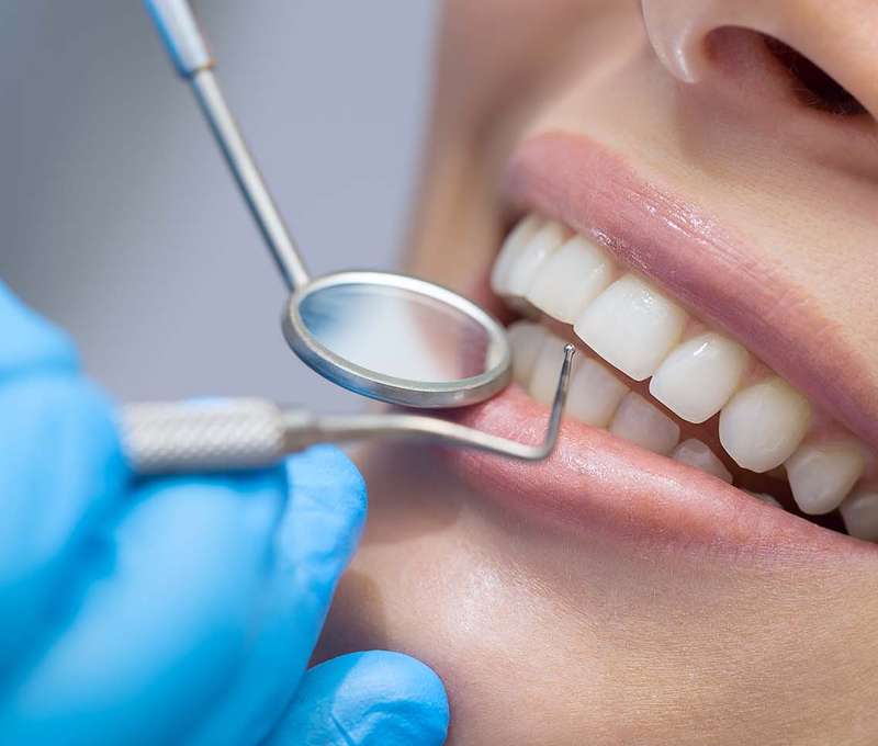 Dentálna hygiena alebo nová korunka
