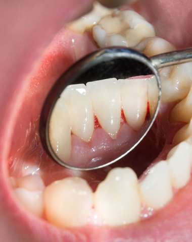 Dentálna hygiena pre váš žiarivý úsmev 