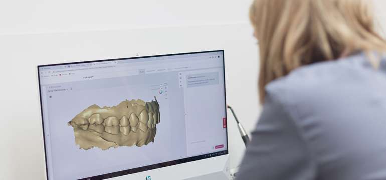 Novinka: 3D virtuálny model vašich zubov