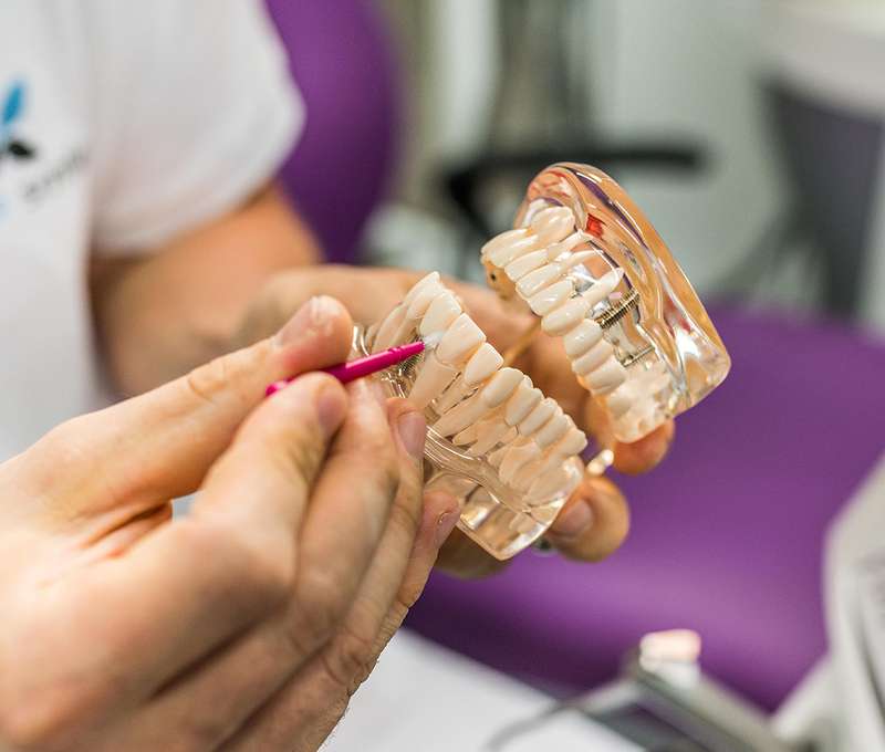 Profesionálna dentálna hygiena vo White Smile v Starom Meste