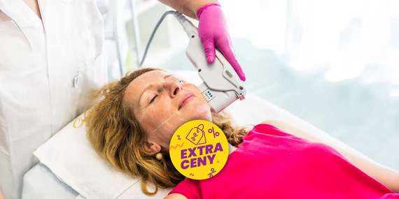 EXTRA CENA: Hifu 12D SMAS ultherapia – neinvazívny facelifting celej tváre/Bratislava - Staré Mesto