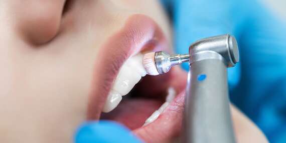 Profesionálna dentálna hygiena, bielenie zubov a ozónoterapia v 24 DENTAL - zubná pohotovosť III.veže/Bratislava - Nové mesto