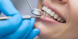 Profesionálna dentálna hygiena