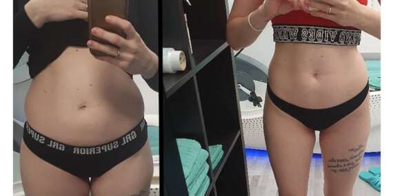 Najúčinnejšie kardio v súčasnosti a moderné tvarovanie postavy: InfraShape a Duo Shaper/Bratislava - Petržalka