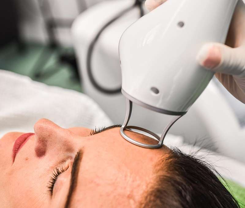 Frakčný resurfacing CO2 - účinné omladenie vašej pokožky v medicínskom centre Crystal Esthetic Clini