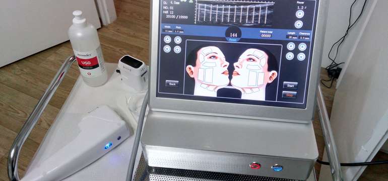 Hifu 3D - lifting tváre (Ultherapia)