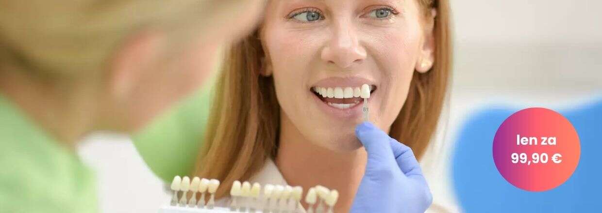 bielenie zubov, biele zuby, domáce bielenie zubov