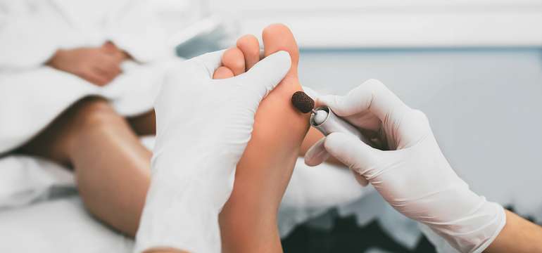 Medicínska kombinovaná pedikúra v Medical Foot Care (ilustračné foto)