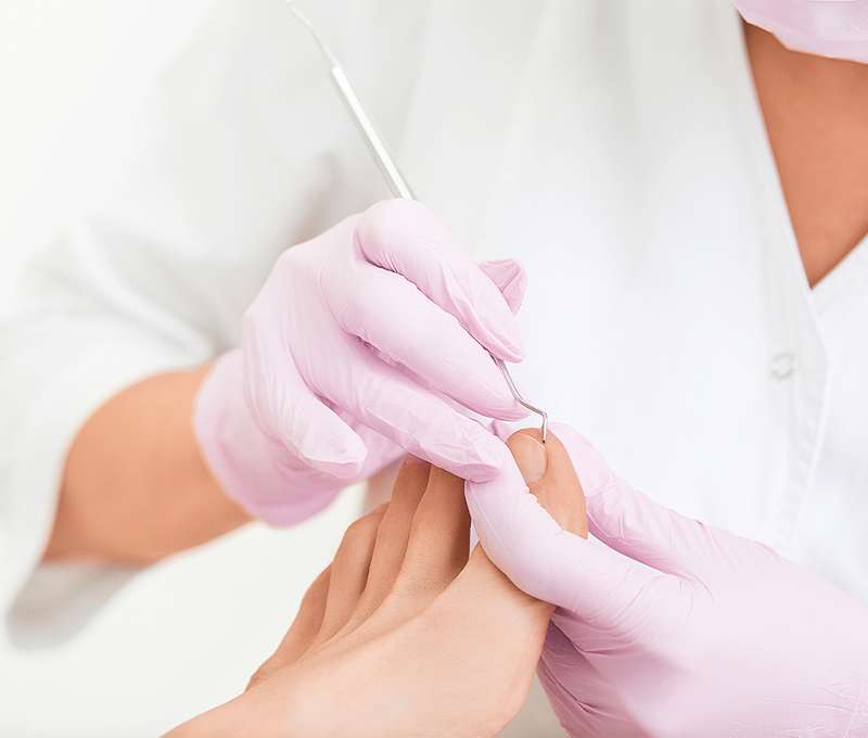 Medicínska kombinovaná pedikúra v Medical Foot Care (ilustračné foto)