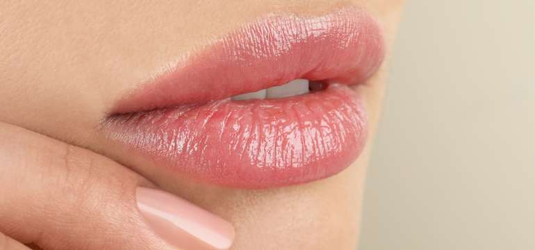 Výplň pier technikou Russian lips pre pôsobivý, ale prirodzený vzhľad (ilustračné foto)