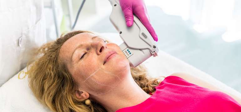 Neinvazívny facelifting Hifu 12D SMAS ultherapia