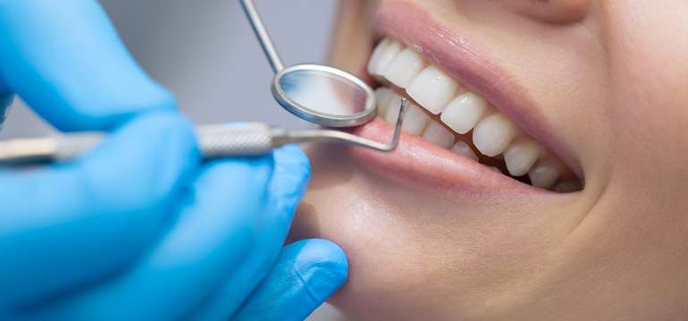 Profesionálna dentálna hygiena