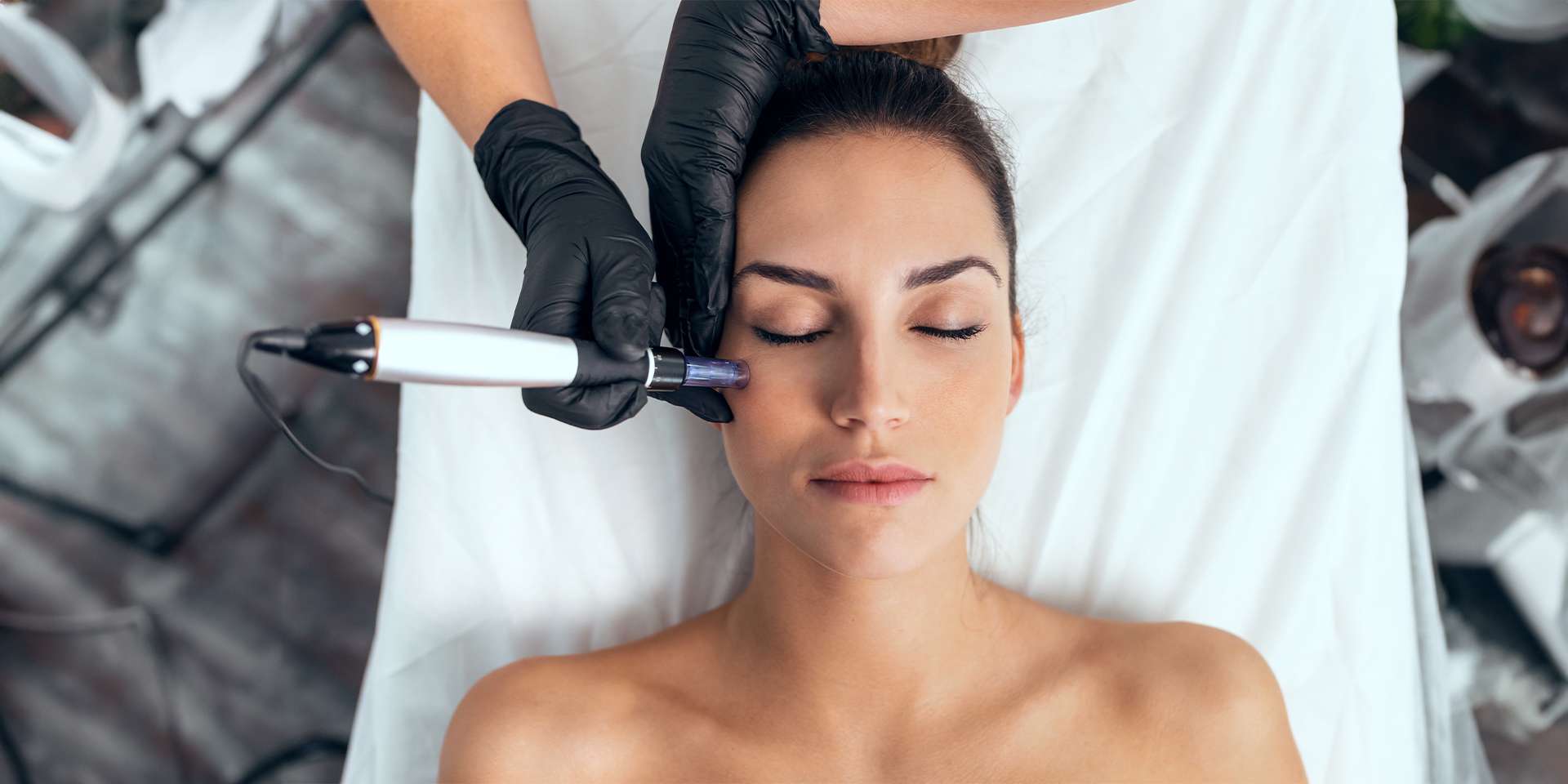 Omladzujúca mezoterapia - microneedling s chemickým peelingom + navyše úprava a farbenie obočia