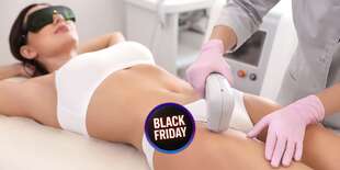 Trvalá epilácia - odstránenie ochlpenia diódovým laserom