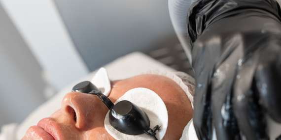 Dajte zbohom cievkam a pigmentáciám - objavte silu aparatívnej kozmetológie/Bratislava - Podunajské Biskupice