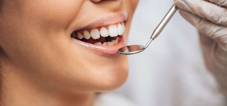 Dentálna hygiena alebo bielenie zubov